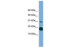 WB Suggested Anti-IL1F5 Antibody Titration: 0. (FIL1d antibody  (Middle Region))
