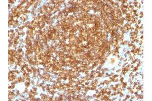 Image no. 2 for anti-CD45RB (CD45RB) antibody (ABIN6170649)
