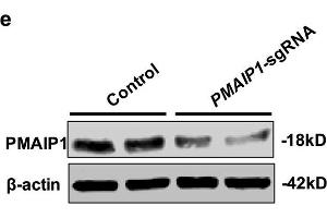 PMAIP1 is a CK-resistant gene. (NOXA antibody  (AA 1-54))