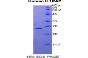 SDS-PAGE of Protein Standard from the Kit  (Highly purified E. (IL1RAP ELISA Kit)
