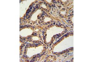 Immunohistochemistry (IHC) image for anti-Natriuretic Peptide A (NPPA) antibody (ABIN2917623) (NPPA antibody)