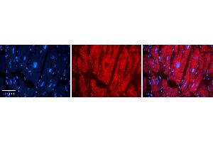 Rabbit Anti-LASP1 Antibody Catalog Number: ARP54798_P050 Formalin Fixed Paraffin Embedded Tissue: Human heart Tissue Observed Staining: Cytoplasmic Primary Antibody Concentration: N/A Other Working Concentrations: 1:600 Secondary Antibody: Donkey anti-Rabbit-Cy3 Secondary Antibody Concentration: 1:200 Magnification: 20X Exposure Time: 0. (LASP1 antibody  (C-Term))