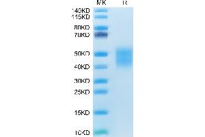 Canine CD28 on Tris-Bis PAGE under reduced condition. (CD28 Protein (CD28) (AA 18-153) (His tag))