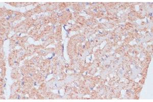 Immunohistochemistry of paraffin-embedded Rat heart using MZB1 Polyclonal Antibody at dilution of 1:100 (40x lens). (MZB1 antibody)