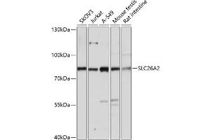 Western blot analysis of extracts of various cell lines, using SLC26 antibody (ABIN7270440) at 1:3000 dilution. (SLC26A2 antibody  (AA 1-111))