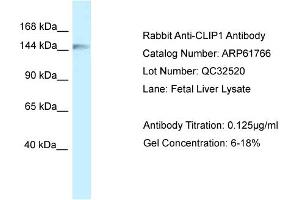 Western Blotting (WB) image for anti-CAP-GLY Domain Containing Linker Protein 1 (CLIP1) (C-Term) antibody (ABIN2788894) (CLIP1 antibody  (C-Term))