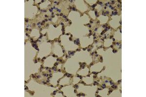 Immunohistochemistry of paraffin-embedded Mouse lung using RNGTT antibody at dilution of 1:100 (x400 lens). (RNGTT antibody)