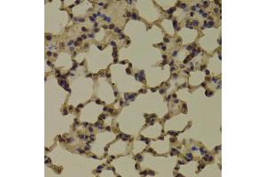 Immunohistochemistry of paraffin-embedded Mouse lung using RNGTT antibody at dilution of 1:100 (x400 lens).