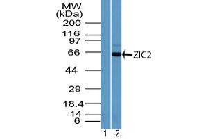 Image no. 1 for anti-ZIC2 (ZIC2) (AA 350-400) antibody (ABIN960412) (ZIC2 antibody  (AA 350-400))