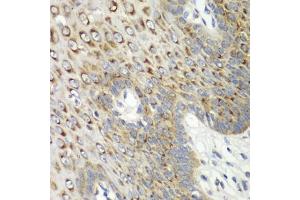 Immunohistochemistry of paraffin-embedded human esophagus using CDK1 antibody (ABIN6134274, ABIN6138303, ABIN6138304 and ABIN6219543) at dilution of 1:100 (40x lens). (CDK1 antibody  (AA 208-258))