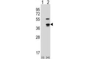 Western Blotting (WB) image for anti-Cyclin-Dependent Kinase 3 (CDK3) antibody (ABIN2997548) (CDK3 antibody)