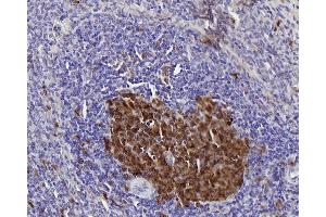 Immunohistochemistry analysis of paraffin-embedded rat spleen using Survivin Polyclonal Antibody at dilution of 1:300. (Survivin antibody)