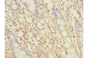 Immunohistochemistry of paraffin-embedded human colon tissue using ABIN7162305 at dilution of 1:100 (SLC6A16 antibody  (AA 1-138))