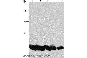 Western blot analysis of A549 and hela cell, mouse liver and human liver tissue, hepG2 cell, using PGK1 Polyclonal Antibody at dilution of 1:850 (PGK1 antibody)