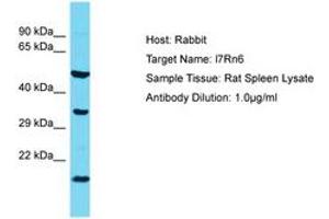 Image no. 1 for anti-Chromosome 11 Open Reading Frame 73 (C11orf73) (AA 37-86) antibody (ABIN6750374) (C11orf73 antibody  (AA 37-86))