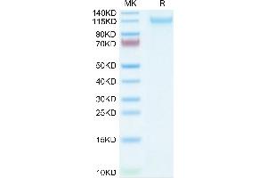 VLDLR Protein (AA 28-797) (His tag)