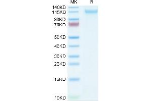 VLDLR Protein (AA 28-797) (His tag)