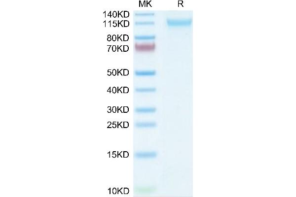 VLDLR Protein (AA 28-797) (His tag)