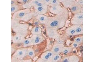 IHC-P analysis of Human Tissue, with DAB staining. (LRP5 antibody  (AA 769-1016))