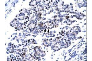 Image no. 3 for anti-Caudal Type Homeobox 4 (CDX4) (C-Term) antibody (ABIN6736267) (CDX4 antibody  (C-Term))
