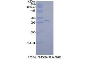 SDS-PAGE analysis of Mouse STAT6 Protein.