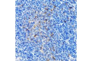 Immunohistochemistry of paraffin-embedded mouse spleen using PSMD10 antibody  at dilution of 1:100 (40x lens). (PSMD10 antibody  (AA 1-226))