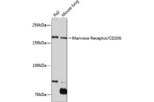 Western blot analysis of extracts of various cell lines, using Mannose Receptor/CD206 Rabbit mAb (ABIN7268388) at 1:1000 dilution. (Macrophage Mannose Receptor 1 antibody)