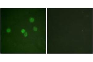 Immunofluorescence analysis of A549 cells, using SP1 (Ab-453) Antibody. (SP1 antibody  (AA 421-470))