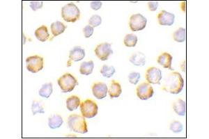 Immunocytochemistry of SIGIRR in A549 cells with this product at 10 μg/ml. (SIGIRR antibody  (C-Term))