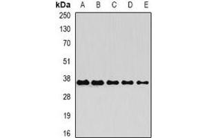 Western blot analysis of OSGEP expression in Raji (A), Jurkat (B), mouse heart (C), mouse ovary (D), rat liver (E) whole cell lysates. (OSGEP antibody)