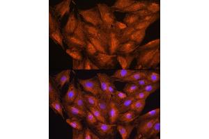 Immunofluorescence analysis of H9C2 cells using D Rabbit pAb (ABIN6127743, ABIN6139383, ABIN6139384 and ABIN6223348) at dilution of 1:100. (DAAM2 antibody  (AA 1-86))