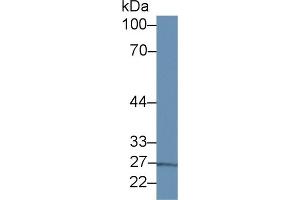 Western Blot; Sample: Porcine Liver lysate; Primary Ab: 2µg/ml Rabbit Anti-Human IL13Ra1 Antibody Second Ab: 0. (IL13 Receptor alpha 1 antibody  (AA 137-210))