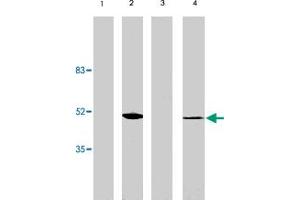 Western blot analysis using VSX2 polyclonal antibody at 1 ug/mL on rat liver (lane 1), retina tissue lysate (lane 2), mouse liver (lane 3) and retina (lane 4) tissue lysate. (VSX2 antibody  (AA 1-131))