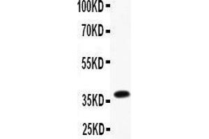 Anti-CD23 Picoband antibody,  All lanes: Anti-CD23 at 0. (FCER2 antibody  (AA 50-331))