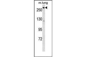 Western blot analysis of LRP5 Antibody (C-term) in mouse lung tissue lysates (35ug/lane). (LRP5 antibody  (C-Term))