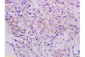 Formalin-fixed and paraffin embedded rat heart labeled with Anti-FLIP Polyclonal Antibody, Unconjugated (ABIN737946) at 1:200 followed by conjugation to the secondary antibody and DAB staining. (FLIP antibody  (AA 401-480))