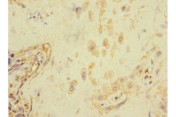 FCRL6 antibody  (AA 20-307)