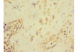 Immunohistochemistry of paraffin-embedded human placenta tissue using ABIN7152671 at dilution of 1:100 (FCRL6 antibody  (AA 20-307))