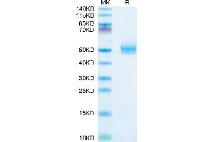 Human TGFBR1 on Tris-Bis PAGE under reduced condition. (TGFBR1 Protein (mFc-Avi Tag))