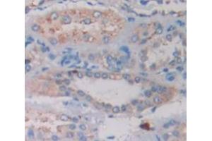 Figure. (Riboflavin Kinase antibody  (AA 1-155))
