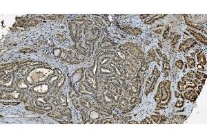 IHC analysis of Transketolase/TKT using anti-Transketolase/TKT antibody (ABIN7598958). (TKT antibody  (AA 1-116))