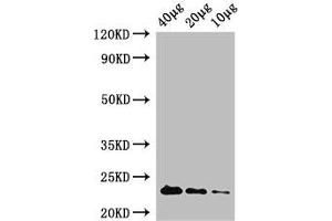 Western Blot Positive WB detected in: Rosseta bacteria lysate at 40 μg, 20 μg, 10 μg All lanes: rpiA antibody at 1 μg/mL Secondary Goat polyclonal to rabbit IgG at 1/50000 dilution Predicted band size: 23 kDa Observed band size: 23 kDa (Ribose 5-Phosphate Isomerase A (RPIA) (AA 1-219) antibody (Biotin))