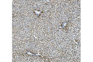 IHC analysis of Glycine decarboxylase/GLDC using anti-Glycine decarboxylase/GLDC antibody (ABIN7602073). (GLDC antibody  (AA 574-1020))