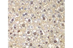 Immunohistochemistry (Paraffin-embedded Sections) (IHC (p)) image for anti-Flap Structure-Specific Endonuclease 1 (FEN1) antibody (ABIN7255764)