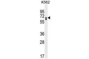 CLIP3 Antibody (C-term) western blot analysis in K562 cell line lysates (35µg/lane).