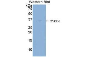 Western blot analysis of the recombinant protein. (KLF4 antibody  (AA 187-474))
