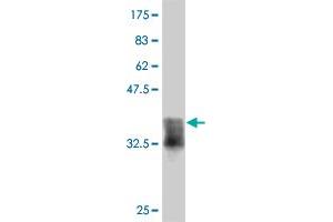 Western Blotting (WB) image for anti-Nuclear Factor of kappa Light Polypeptide Gene Enhancer in B-Cells 1 (NFKB1) (AA 860-969) antibody (ABIN561981)