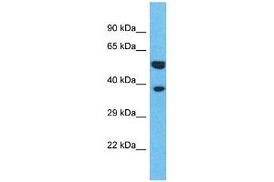Western Blotting (WB) image for anti-Olfactory Receptor, Family 4, Subfamily L, Member 1 (OR4L1) (C-Term) antibody (ABIN2791742) (OR4L1 antibody  (C-Term))