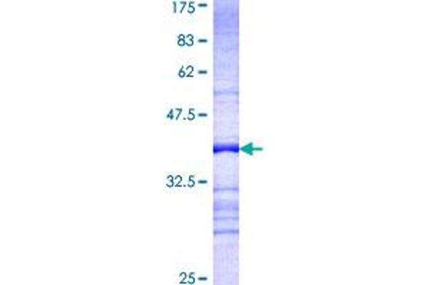 GADD34 Protein (AA 1-100) (GST tag)