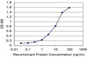 Detection limit for recombinant GST tagged DLX1 is approximately 0. (DLX1 antibody  (AA 181-254))